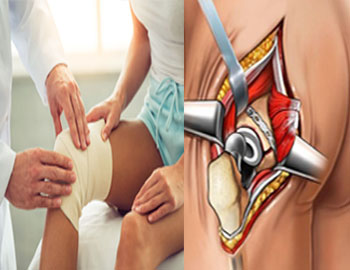 Knee and Hip Replacement